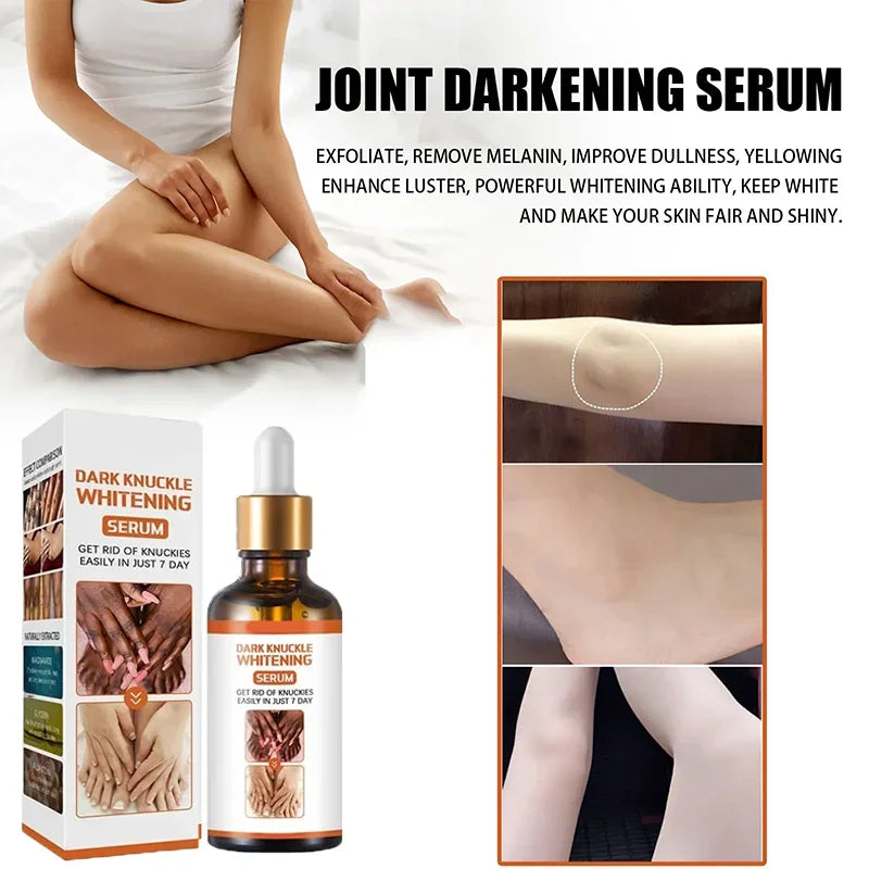 Skin Whitening Cream Cashymart